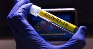 Estudio: anticuerpos por COVID-19 podrían persistir 9 meses tras la infección